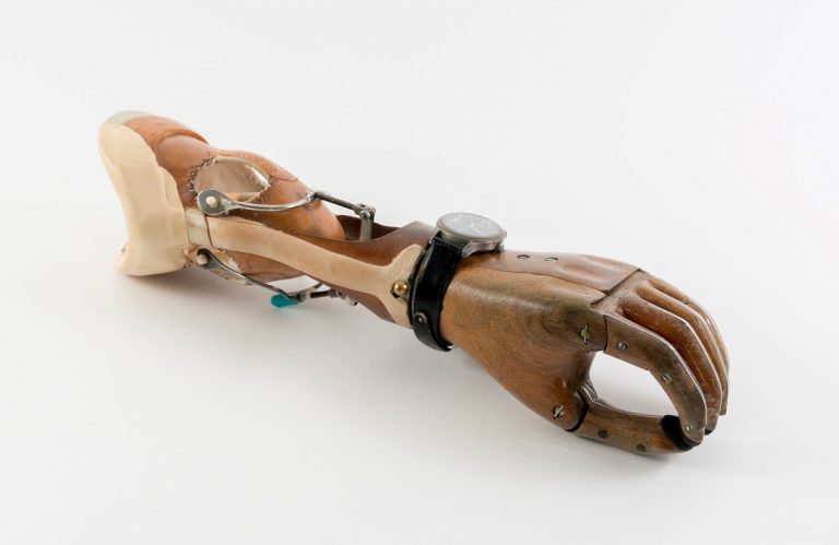 Hybride Mittagsvisite: Künstliche Hand