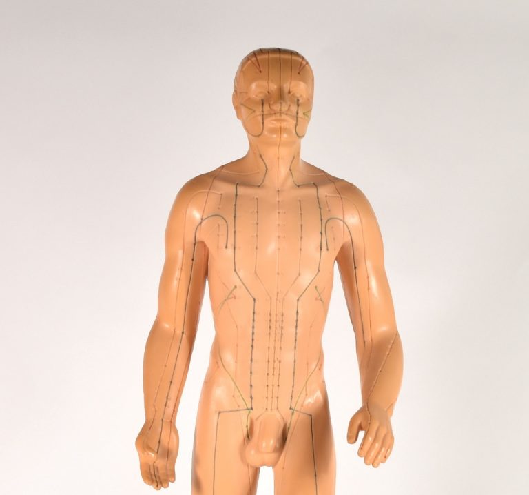 Akupunktur-Modell in der Mittagsvisite