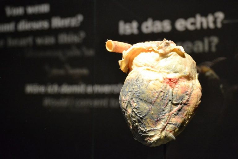 Ansichtssache(n) im Medizinhistorischen Museum